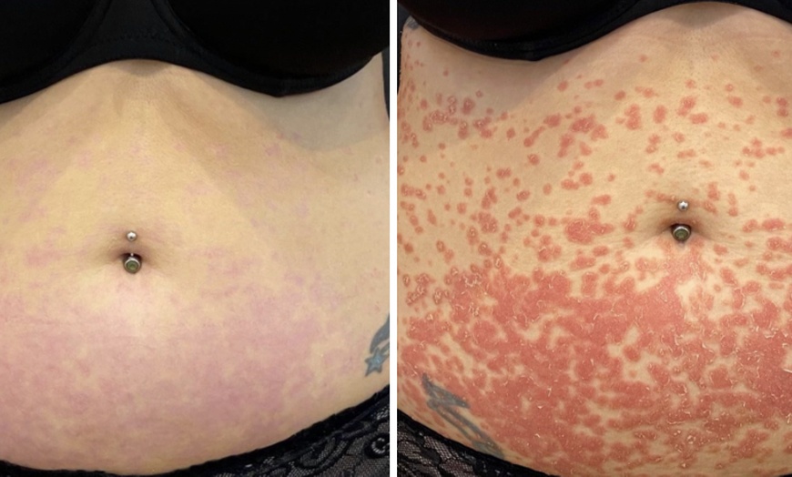 Image 8: Achieve Radiance with 6, 10, or 20 Dermalux MD Triwave LED Therapy 