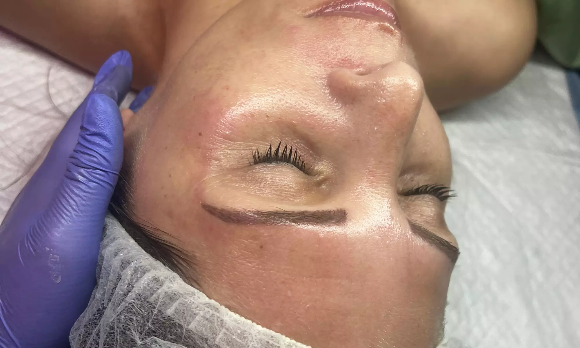 Up to 35% Off on Facial at Duda bastos aesthetics - Primary Image