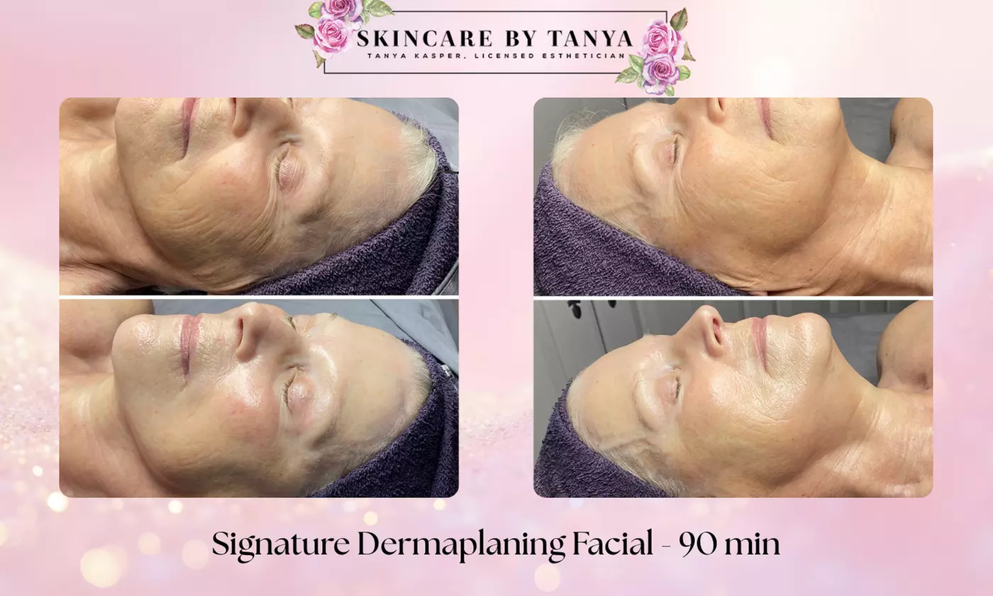 Unlock radiant skin at Skincare by Tanya with dermaplaning, microderm, and spa facials, offering up to 35% off