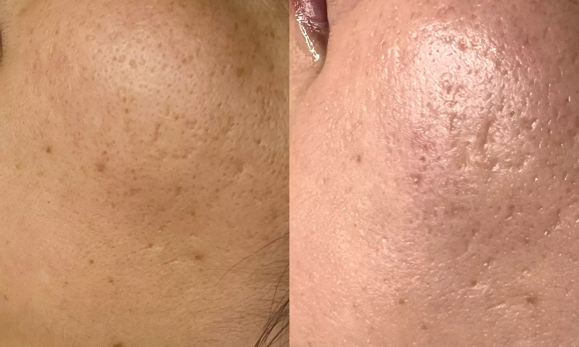Up to 48% Off on Anti-Aging Facial at Soul Aesthetics LLC - Second Medium