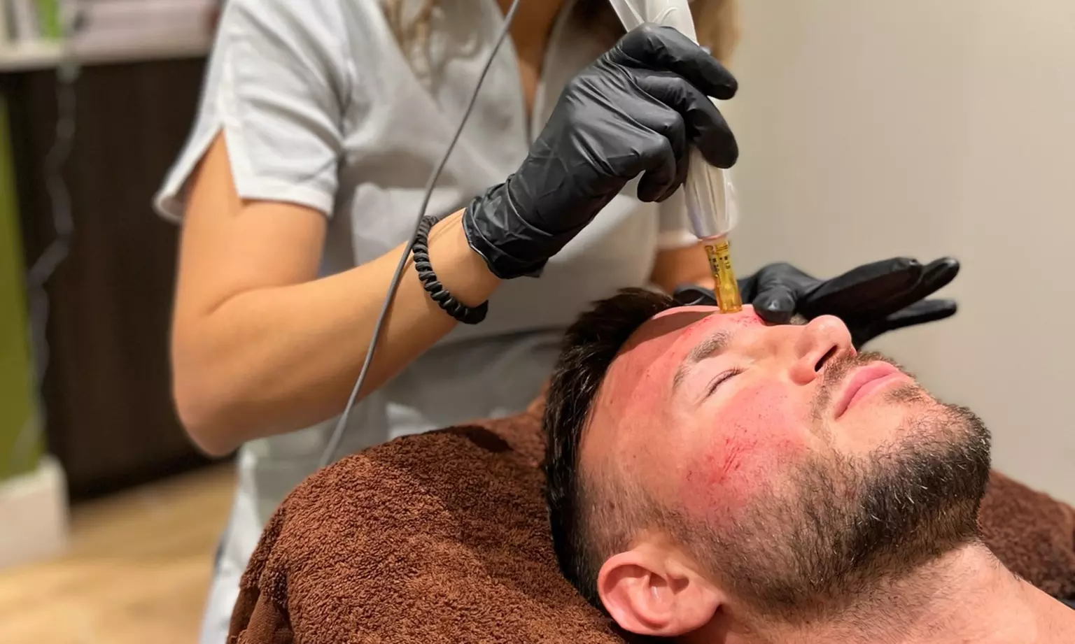 Up to 55% Off on HydraFacial at Profile Aesthetics & Wellness - Primary Image