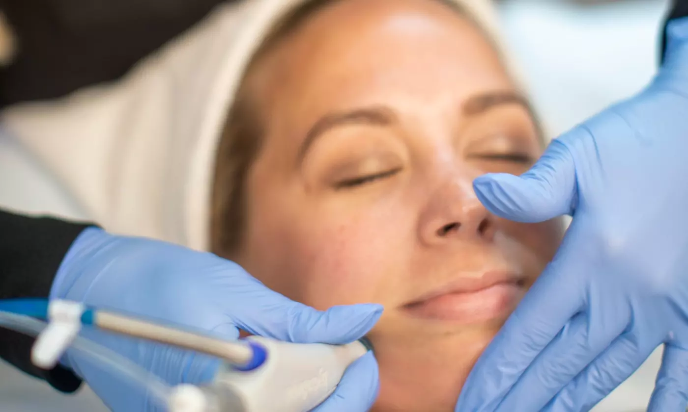 Up to 66% Off on HydraFacial at Skin Body Soul - Primary Image