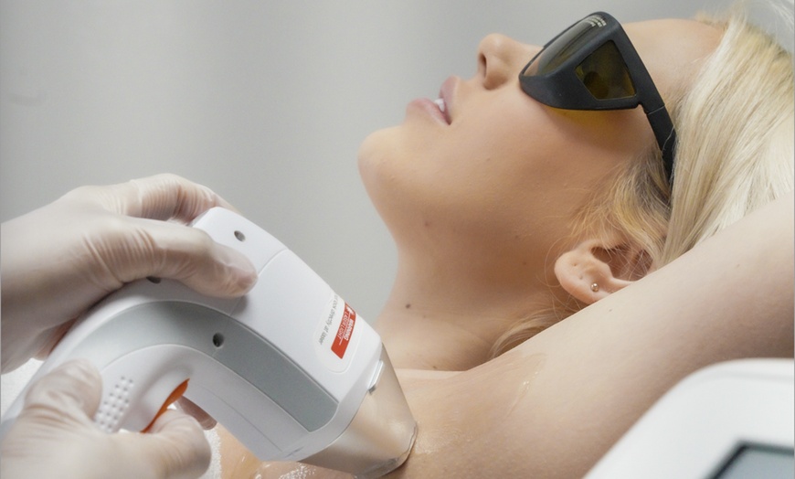 Image 10: Laser Hair-Removal Session: Your Path to Flawless Skin