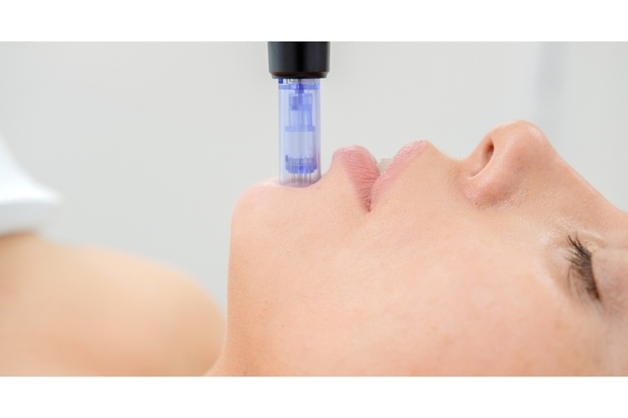 Rejuvenate Your Skin with HIFU and Nano Needling at Korean Skincare