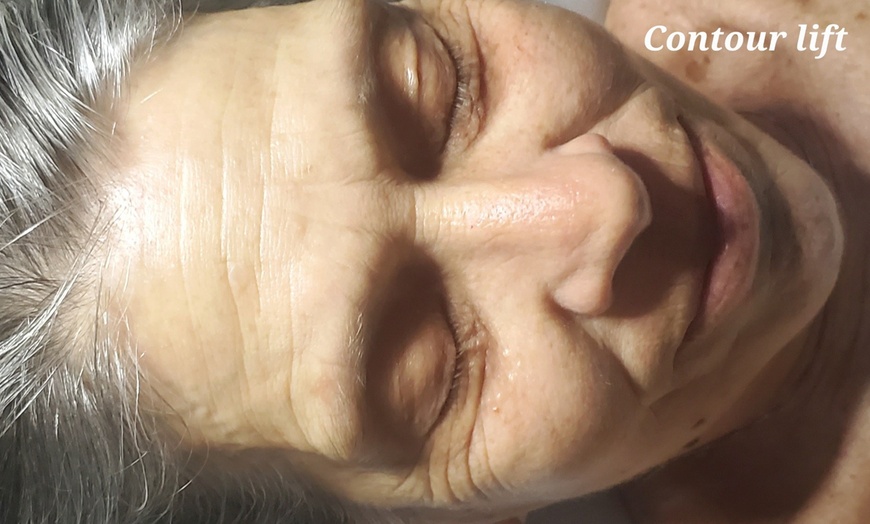 Image 3: Up to 66% Off on Facial at Everglo Spa