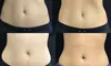 Up to 73% Off on Ultrasonic Fat Reduction at Little Moon & CB LLC