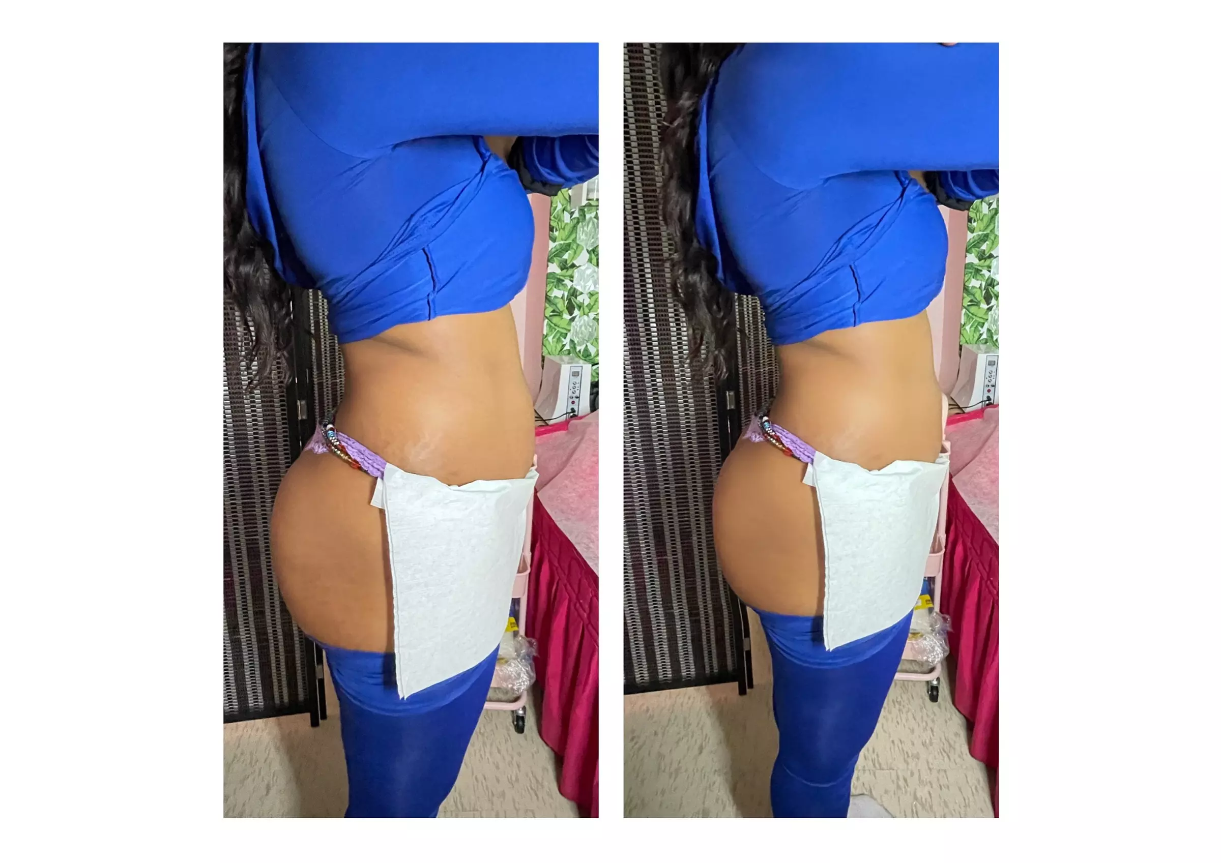 Up to 57% Off on Non-invasive Body Contour at Nessa Finestyle Boutique - Primary Image