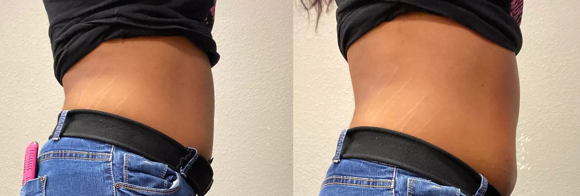 Up to 46% Off on Body Sculpting at BODY BY ART