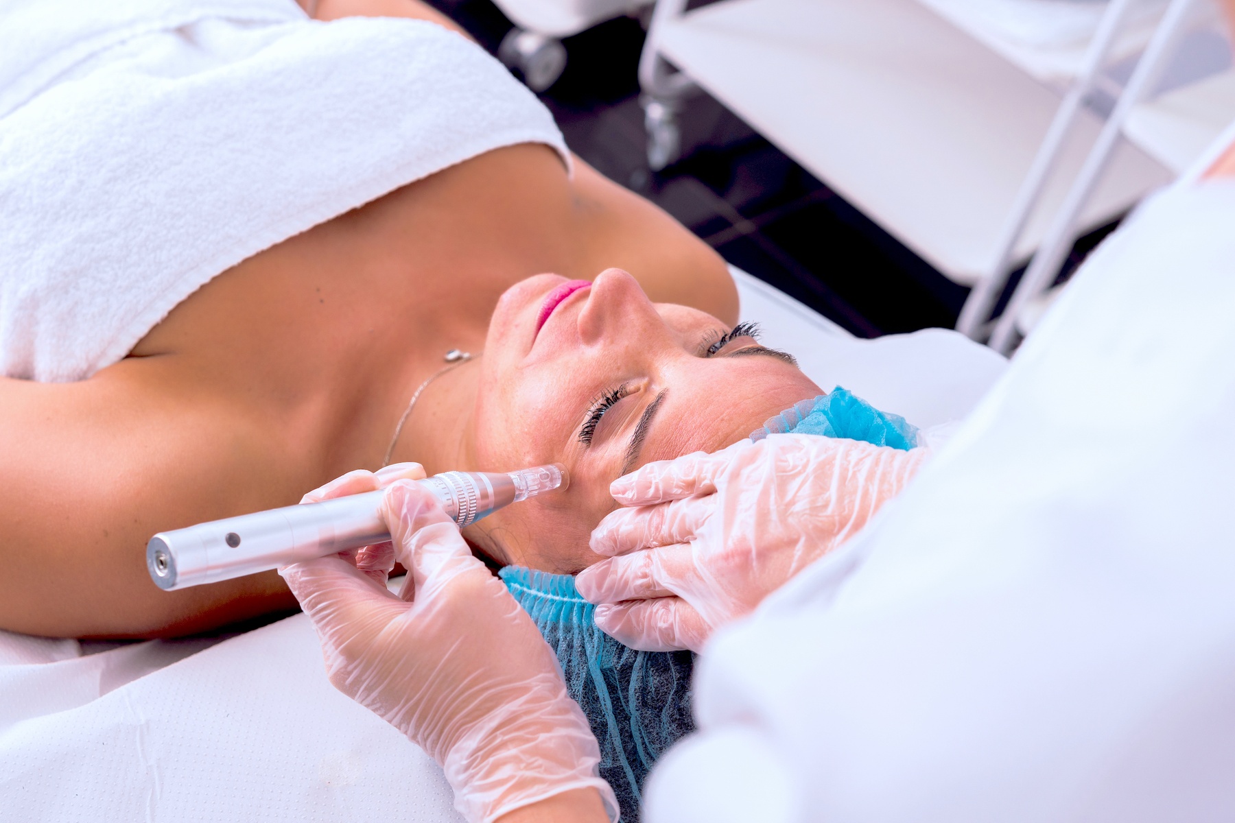 Transform Your Skin with Micro-Needling Treatments