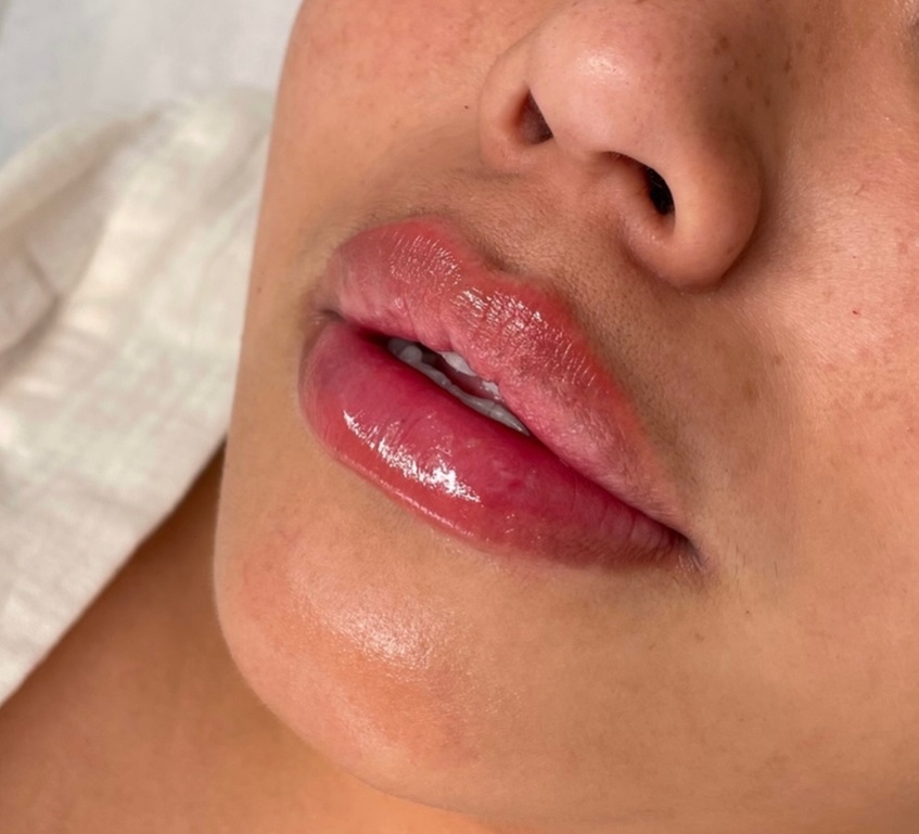 At Endlessfix Beauty Bar, discover lip filler and fat reduction options with up to 66% off, tailored for your beauty needs.