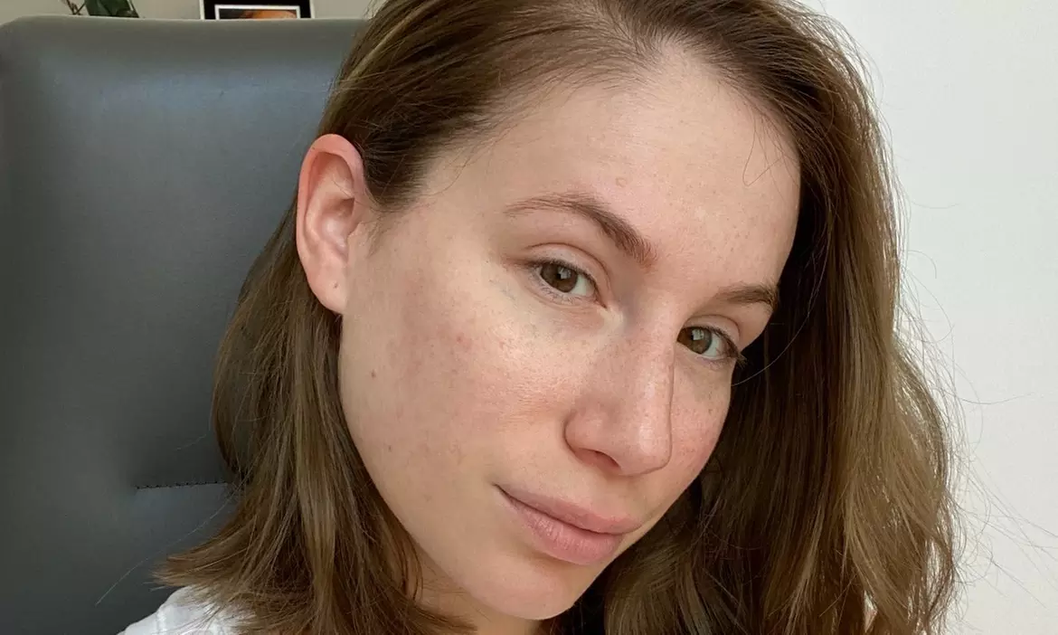 Up to 23% Off on Facial - Pore Care at Skin Sculpt Spa - Second Medium
