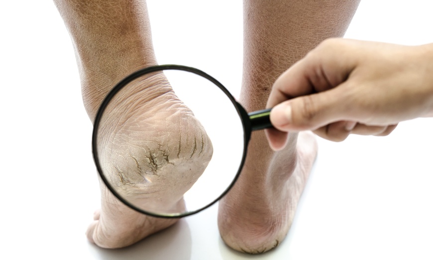 Image 9: General Foot Advice Consultation Available for Your Foot Health