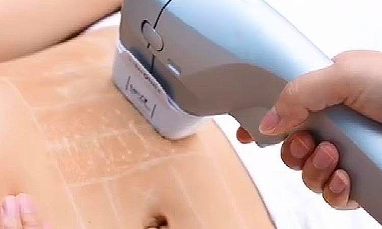 Up to 42% Off on HIFU 3D Fat Burner and skin Tightening at Fascino Med Spa