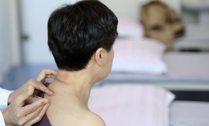 Image 3: Up to 56% Off on Acupuncture Services at Cupping Point - Acupuncture | Hijama | Massage