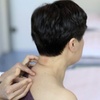 Image 3: Up to 56% Off on Acupuncture Services at Cupping Point - Acupuncture | Hijama | Massage