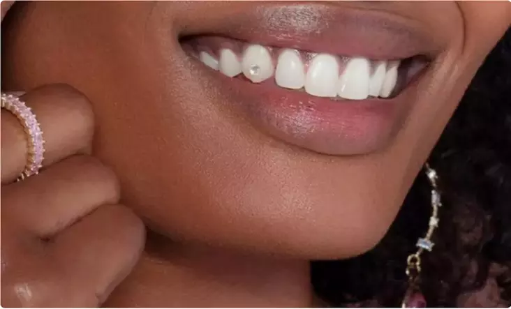Up to 40% Off on Teeth Whitening at Jumpin' Out the Gem - Second Medium