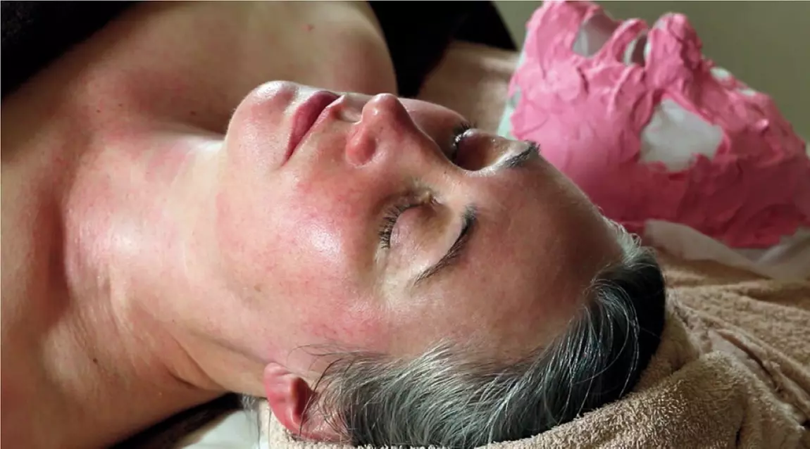 Up to 50% Off on Chemical Peel at Meraki beauty and wellness - Primary Image