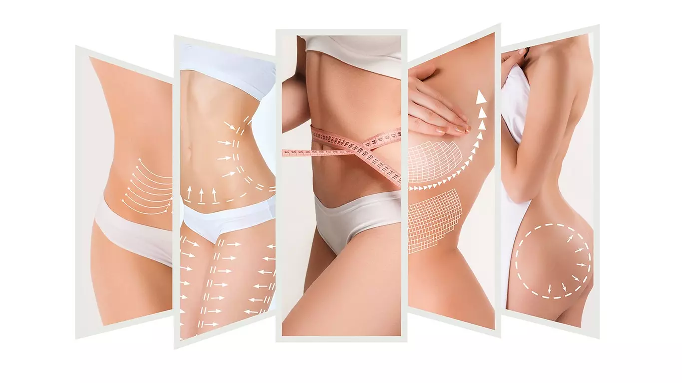 Up to 63% Off on Ultrasonic Fat Reduction at Fusion Medispa - Primary Image