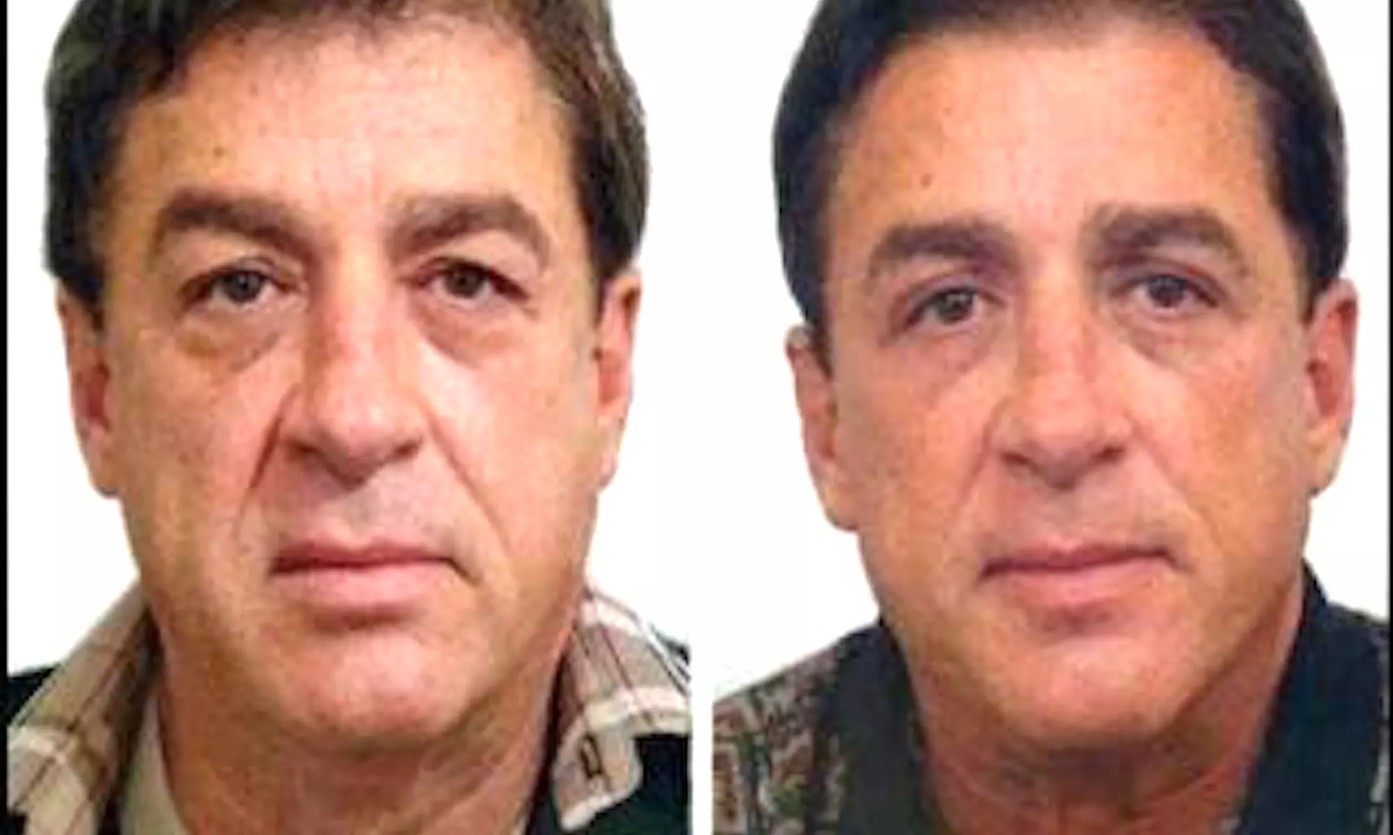 Up to 55% Off on Facial - Anti-Ageing at United Kingdom