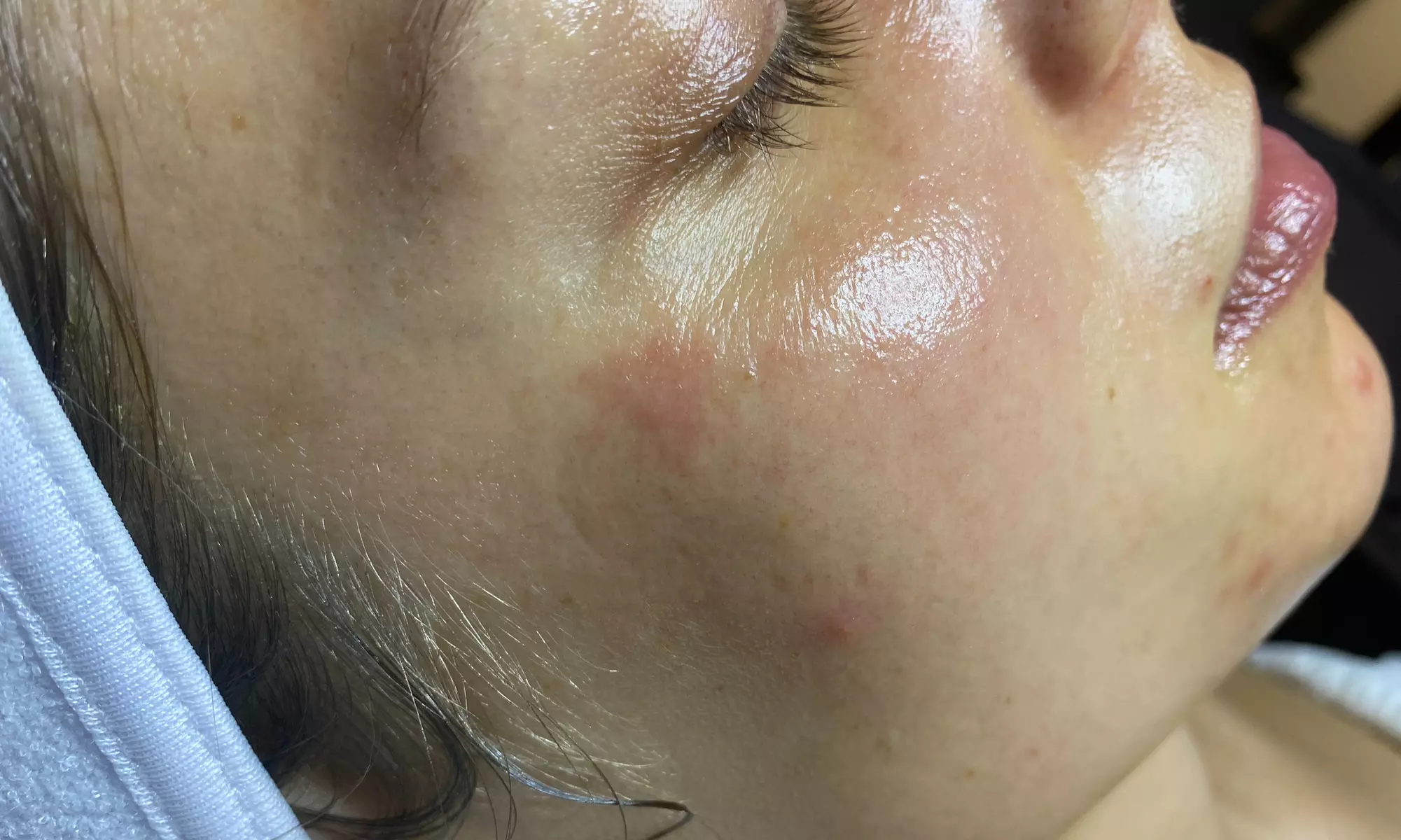 Up to 45% Off on Facial - Oxygen at Kylie Anne Esthetics