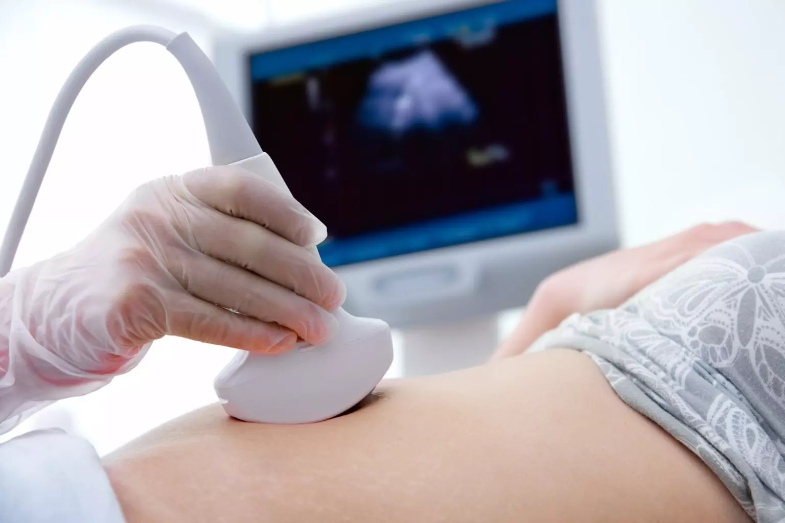 Up to 51% Off on Ultrasound - 3D / 4D at Shantique Medspa - Primary Image