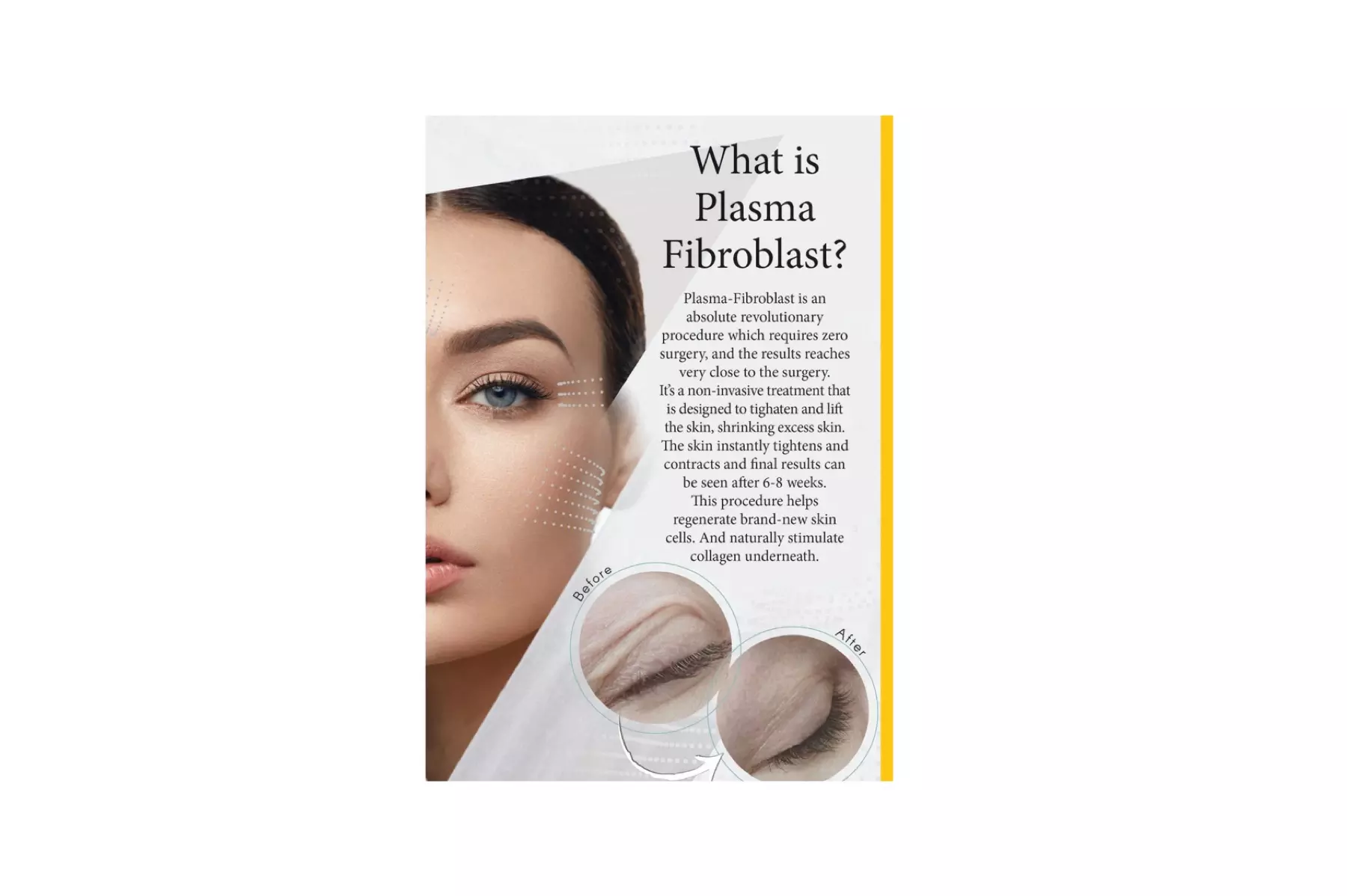 Up to 46% Off on Injection - Plasma