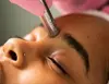 Up to 46% Off on Microdermabrasion at Yoni Fx Esthetics