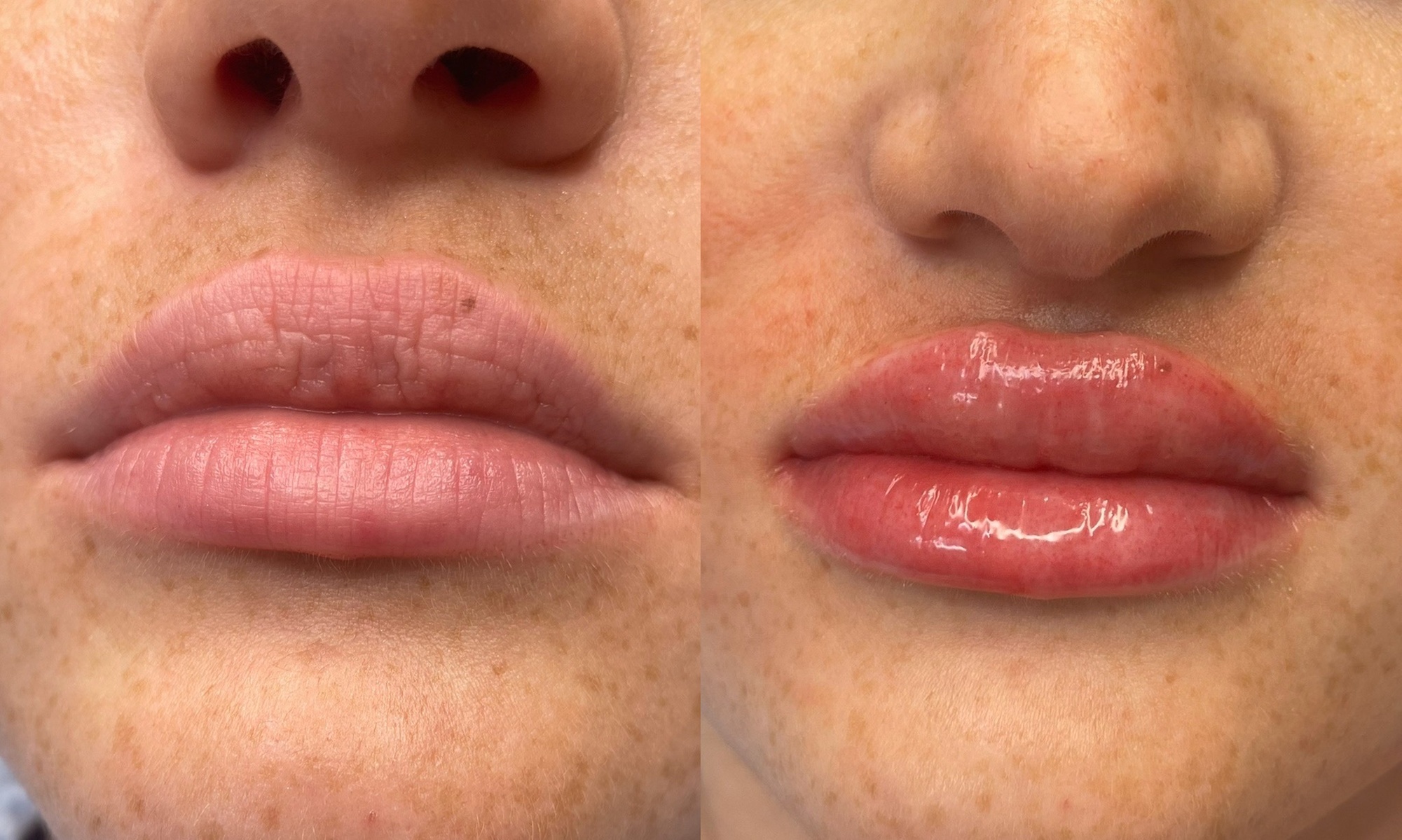 Expert Lip Blushing for a Natural and Lasting Sexy Pout