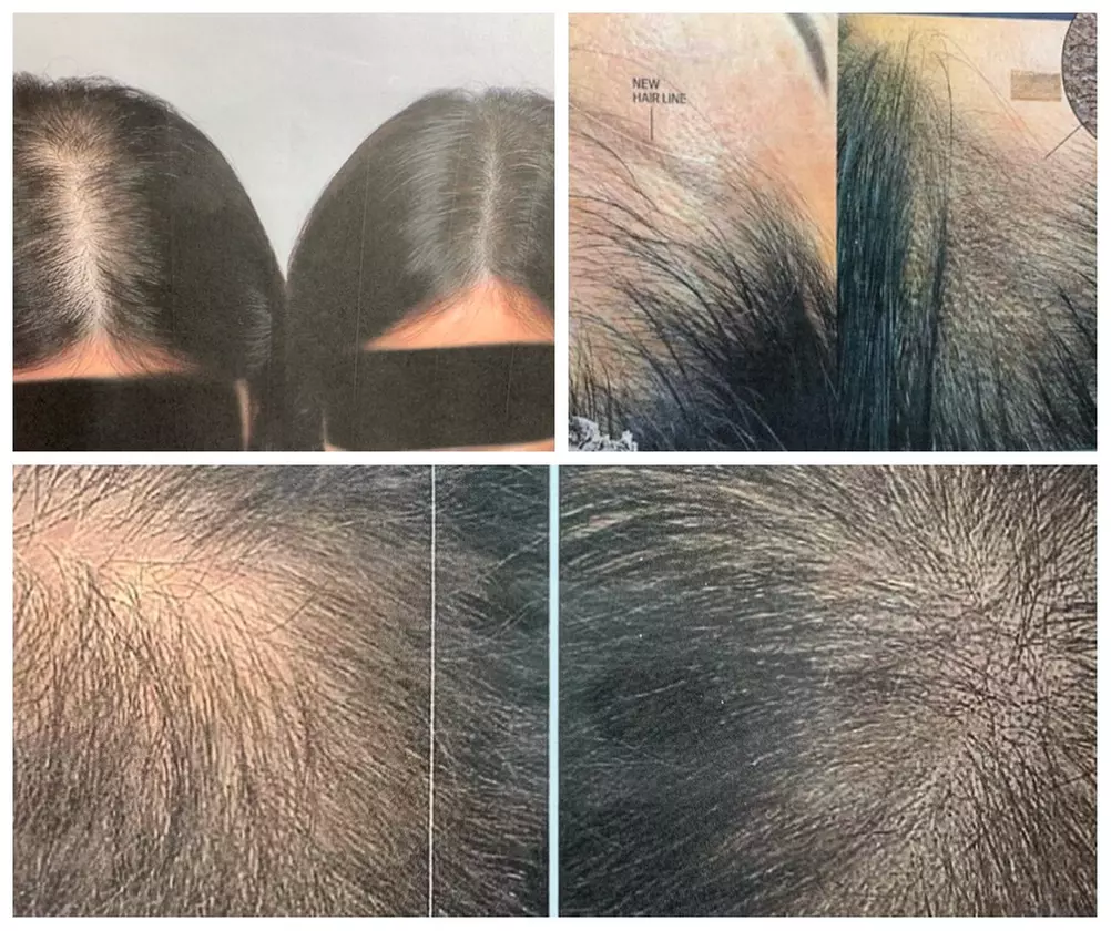 Explore Grace's Brows microblading and scalp micropigmentation with options for touch-ups, offering up to 50% off. - Second Medium