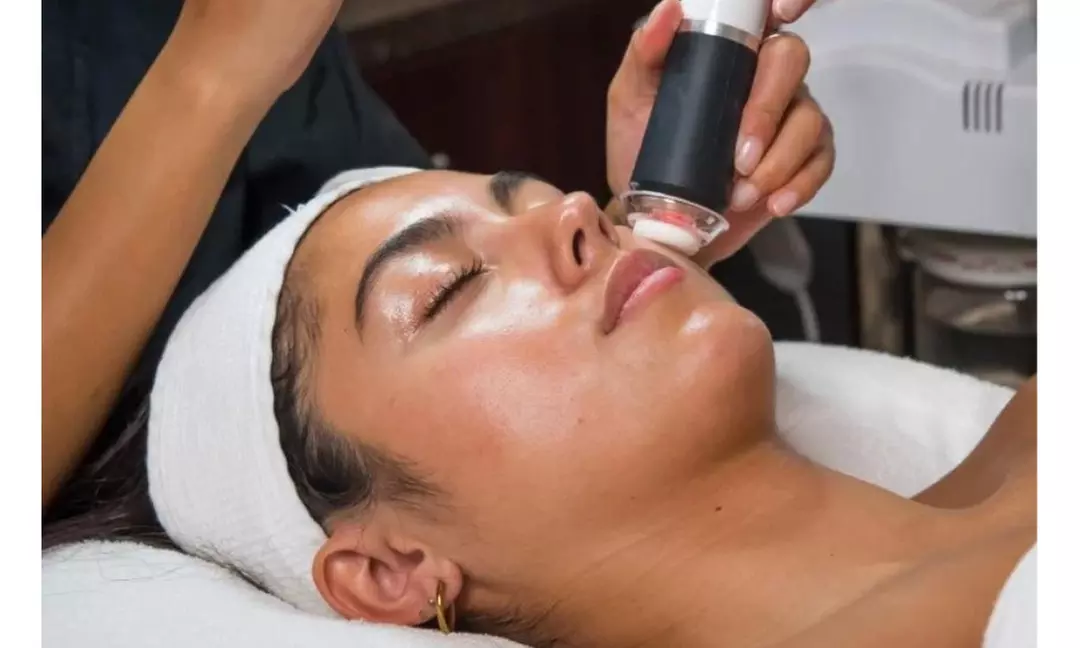 Up to 33% Off on Facial - Caviar at Pretty Lyfe Esthetics