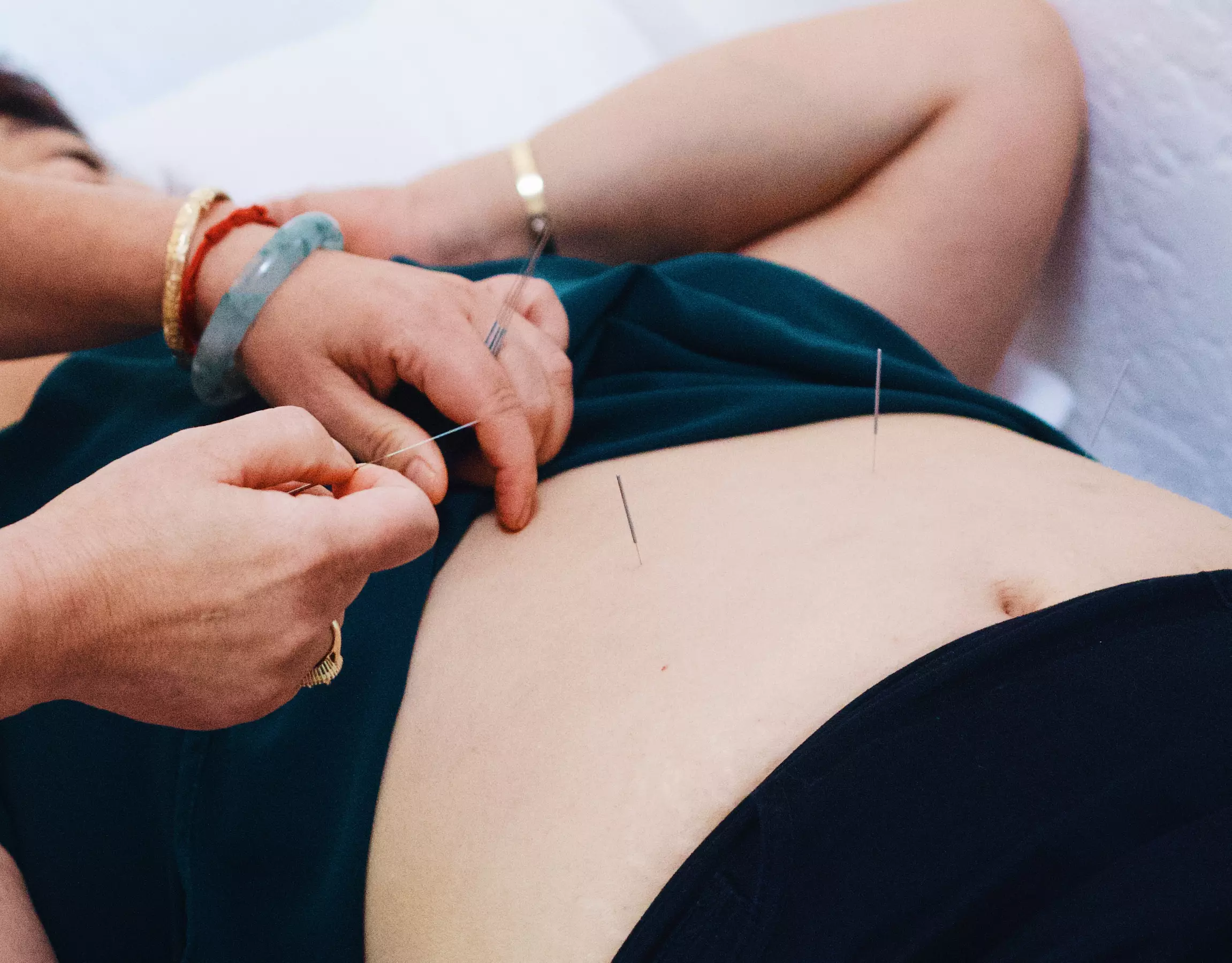 Rejuvenate Your Body: Cryotherapy, Acupuncture and More