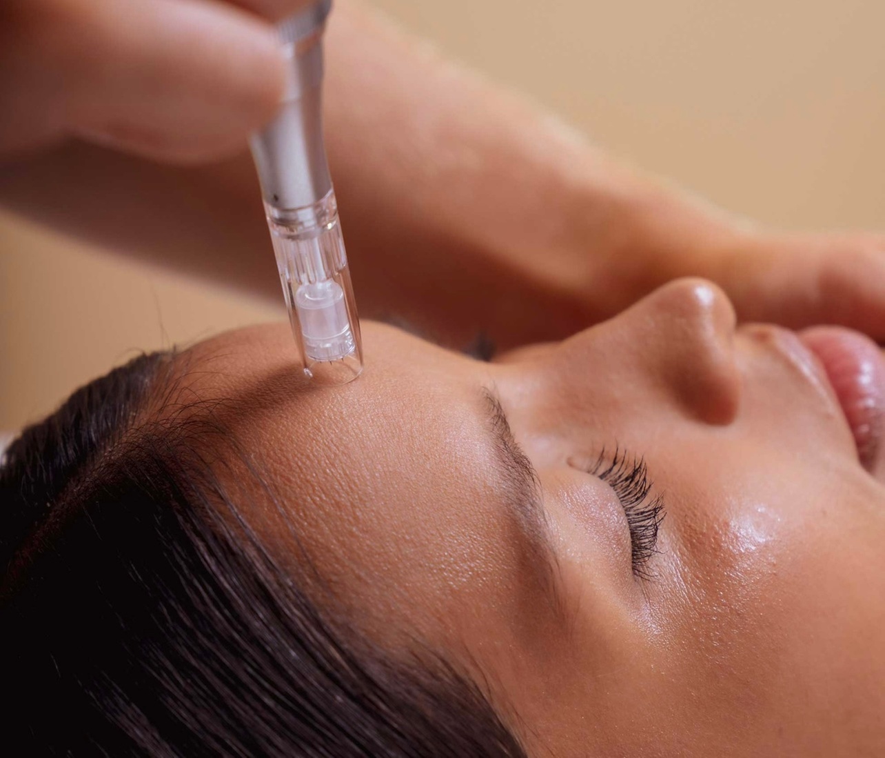One Microneedling Session for a Rejuvenating Skin Experience