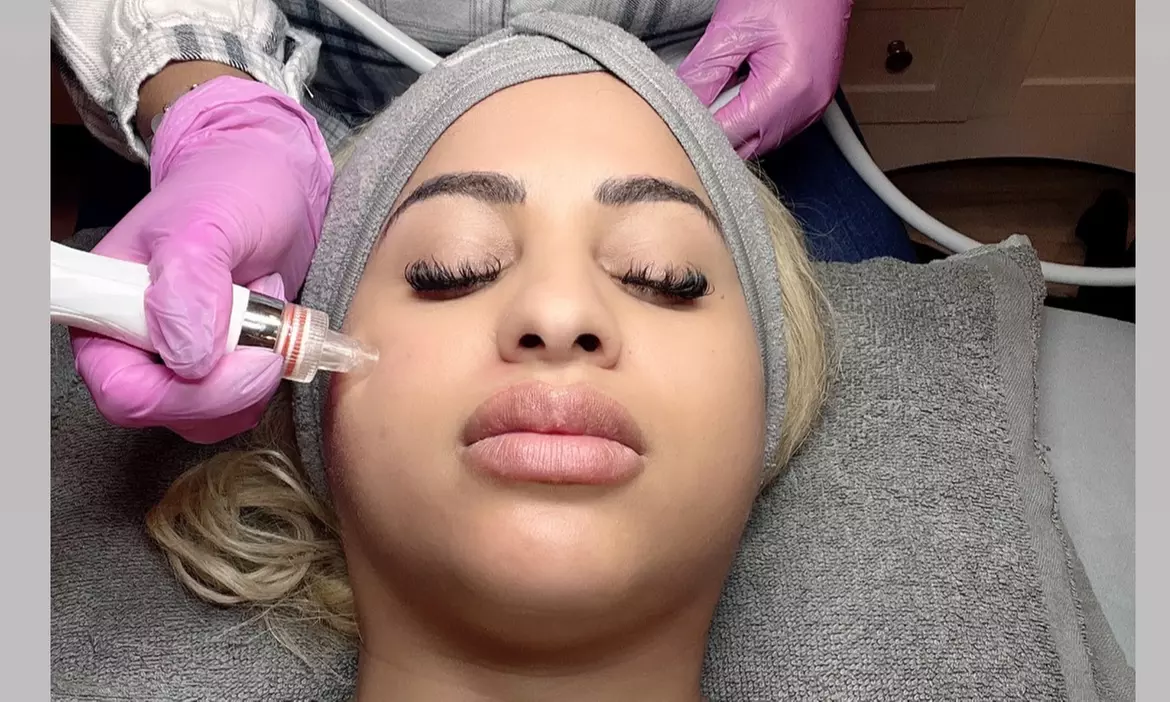Brows And Beauty Bar offers a rejuvenating HydraFacial experience, promoting softer, glowing skin with up to 40% off. - Primary Image