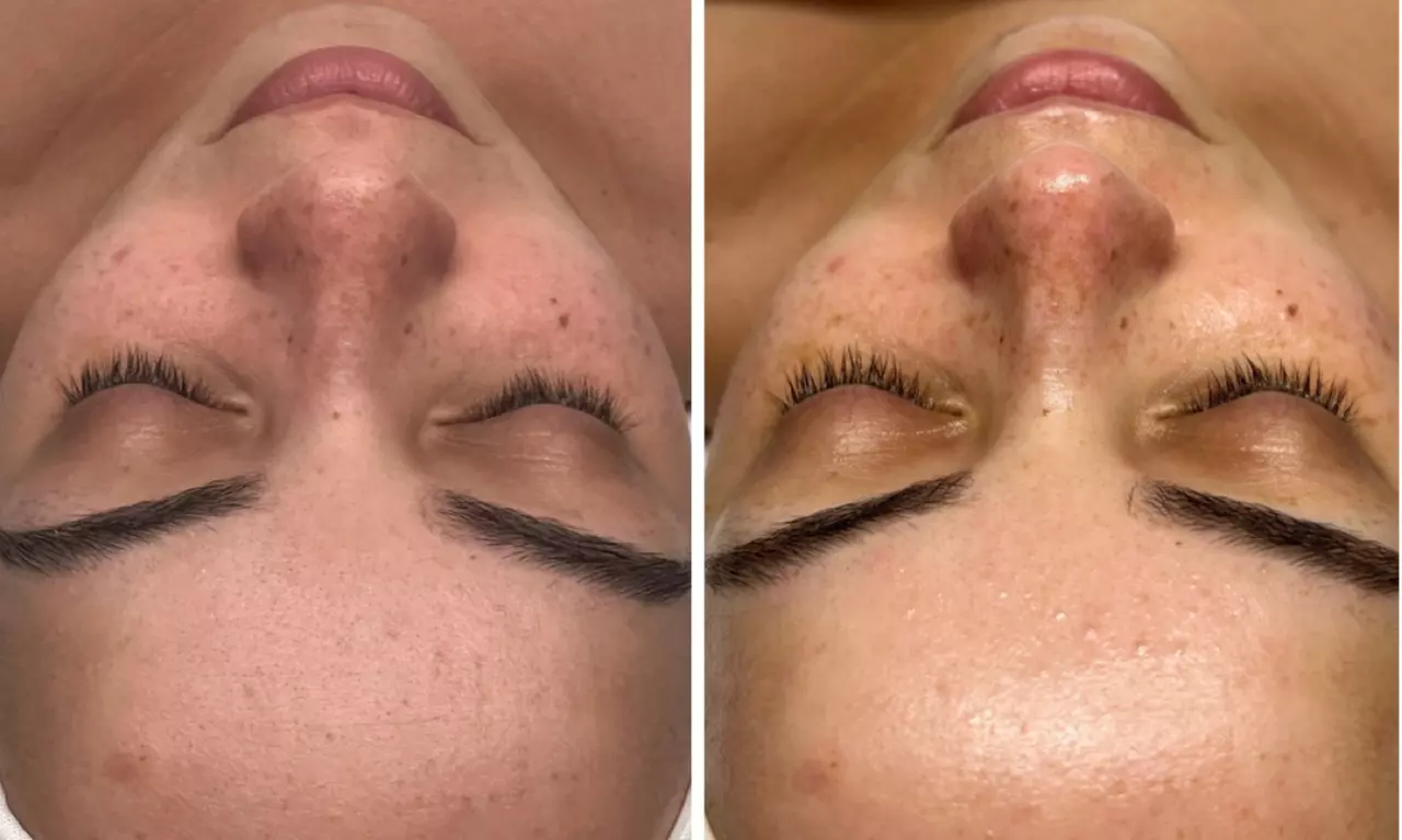 Up to 42% Off on Facial at Bella Chique Esthetics - Second Medium