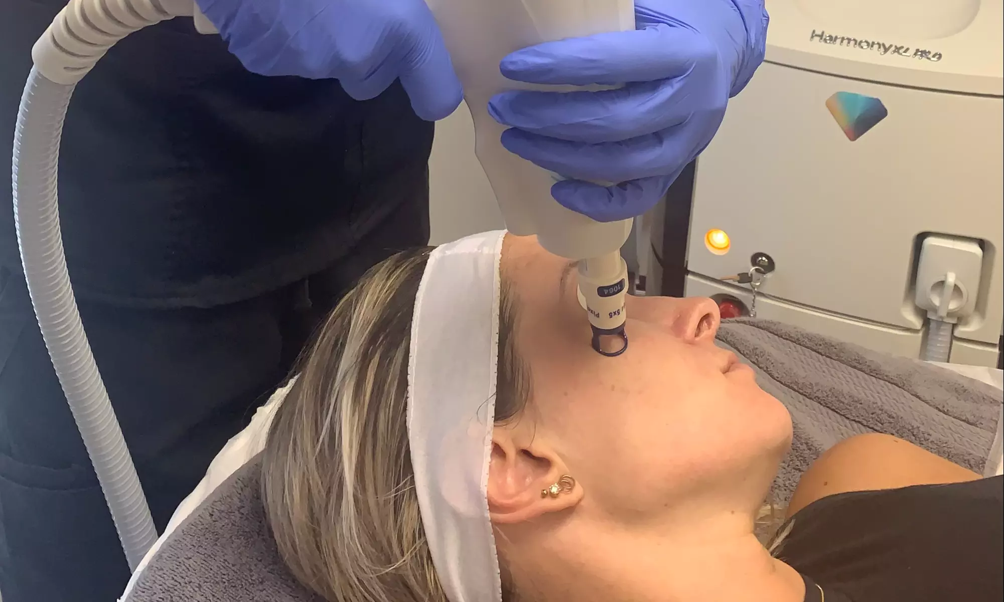 Non-surgical facelift sessions for youthful skin rejuvenation