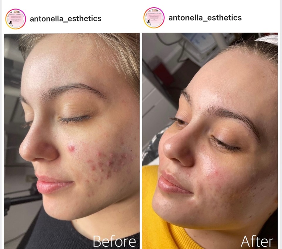 Choice of Facial Treatments in Spa for Radiant Skin