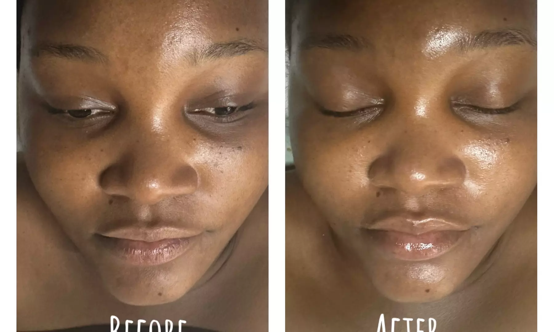 Explore Rejuvenating Facials for Every Skin Type and Need