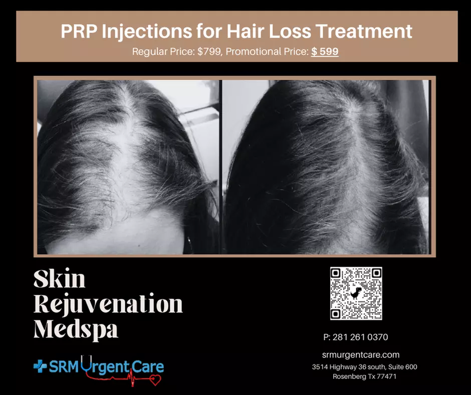 Rejuvenate with PRP Hair Restoration Treatment or Facial Injections