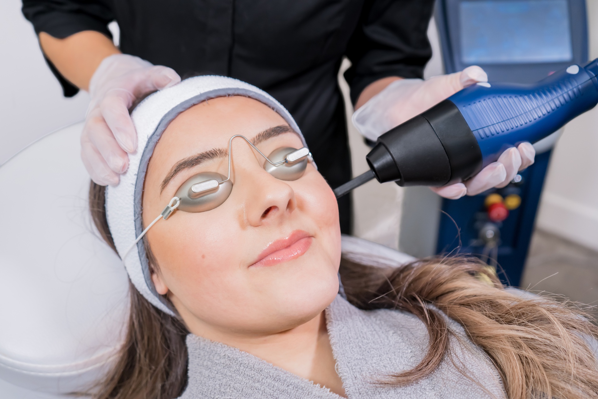 One, Two, or Three Laser Sun Spot or Rosacea Treatments (Up to 68% Off) - Primary Image