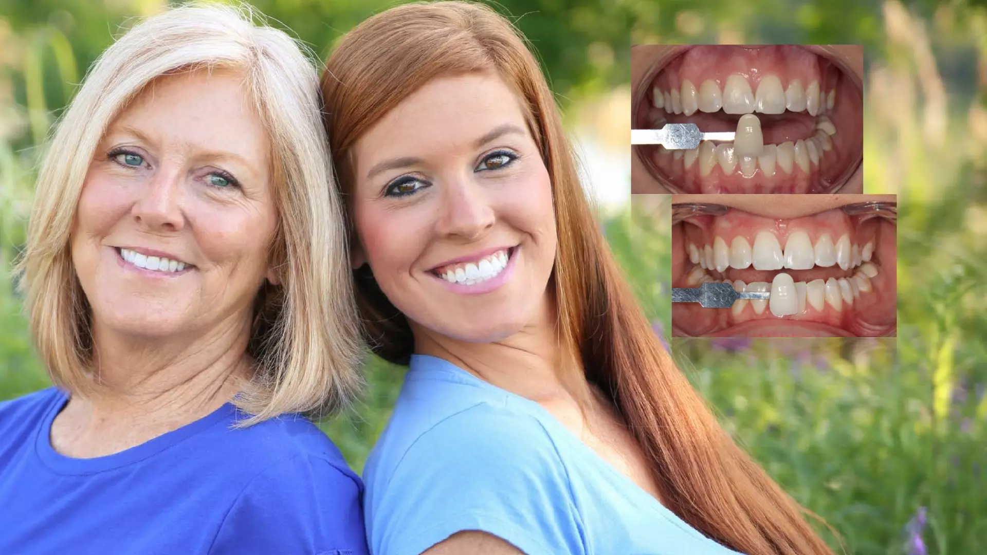 Up to 50% Off on Teeth Whitening at The Whitening Shop - Primary Image