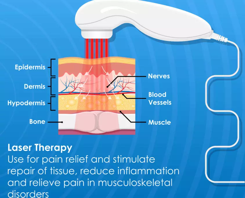 Therapeutic Class IV Laser Therapy: Single or Three Sessions Available