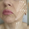 Image 6: Celebrity-Coveted Cheek Pop or Snatched Jawline with PDO Threads at No Pain All Gain Spa (Up to 30% Off)