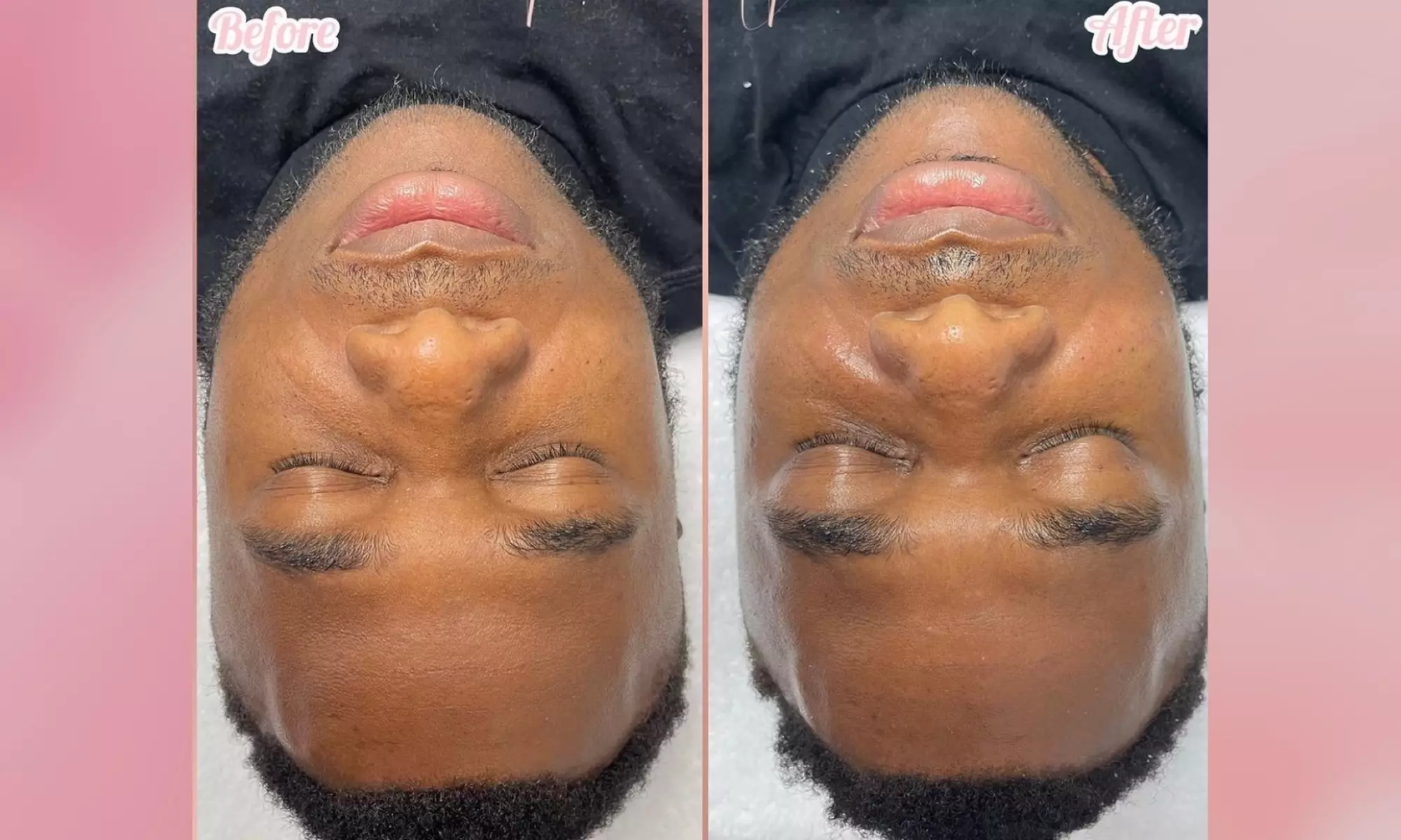 Experience a Men's Facial for Clean and Radiant Skin