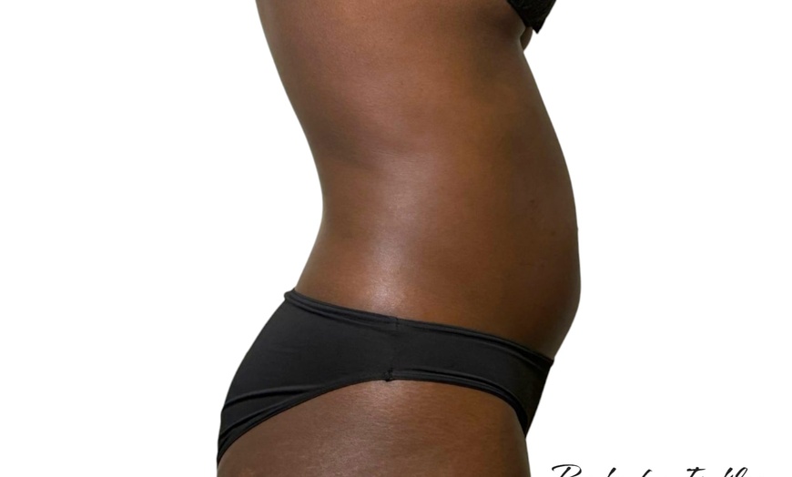 Image 6: One, Three or Six Ultrasound Cavitation Sessions or Wood Therapy