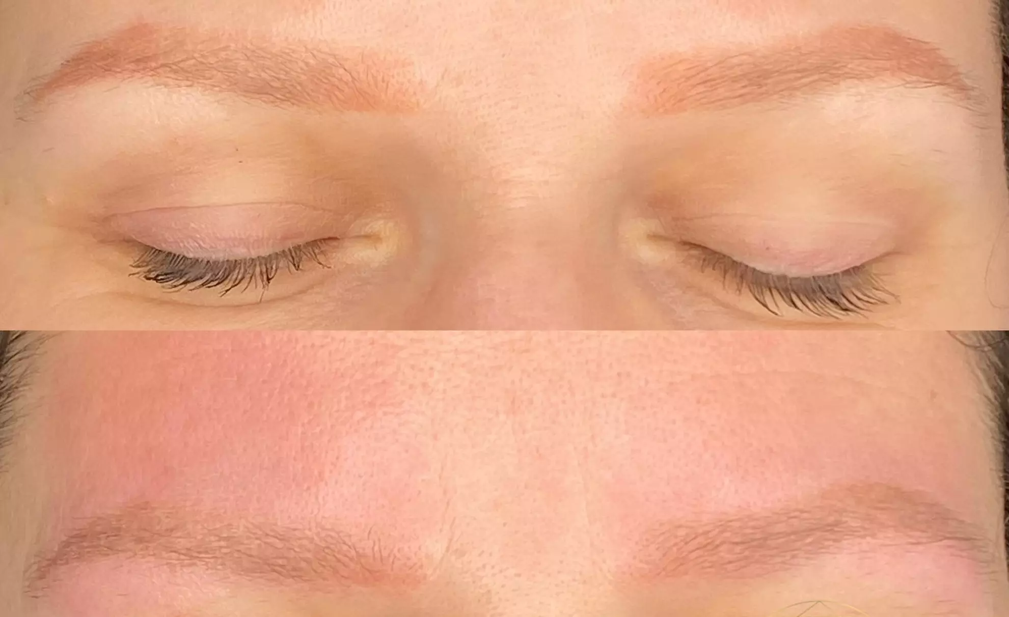 Laserowe oraz bezlaserowe usuwanie makijażu permanentnego brwi i ust