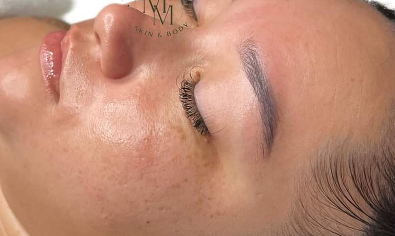 Unleash Radiance at Am'Ma Skin Studio: Enjoy Up to 50% Off on One Oxygen Facial!