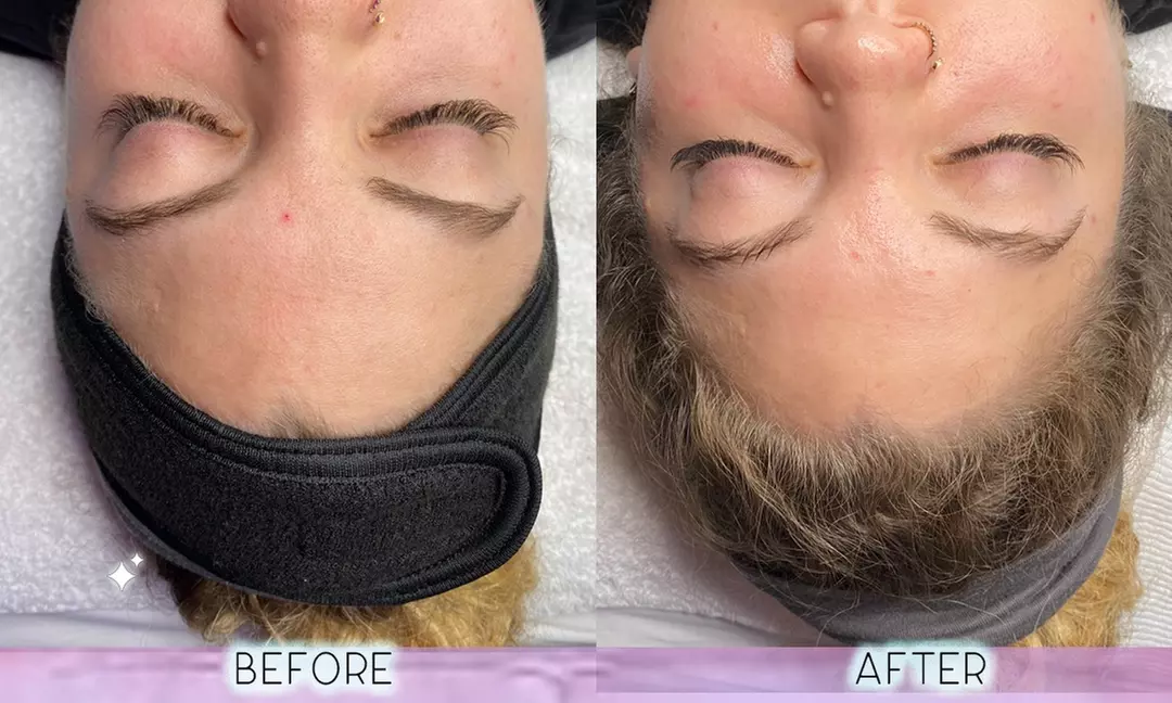 Up to 29% Off on Facial at Moonbow Spa - Primary Image
