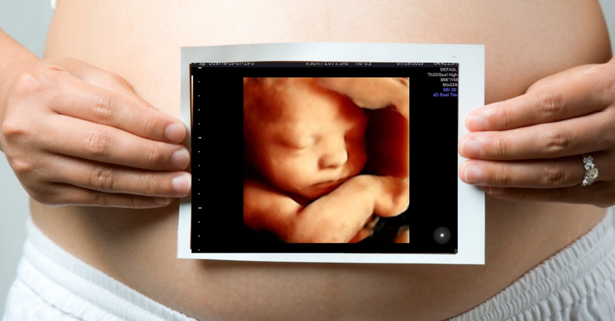 Experience the Joy of 3D/4D Ultrasound Sessions
