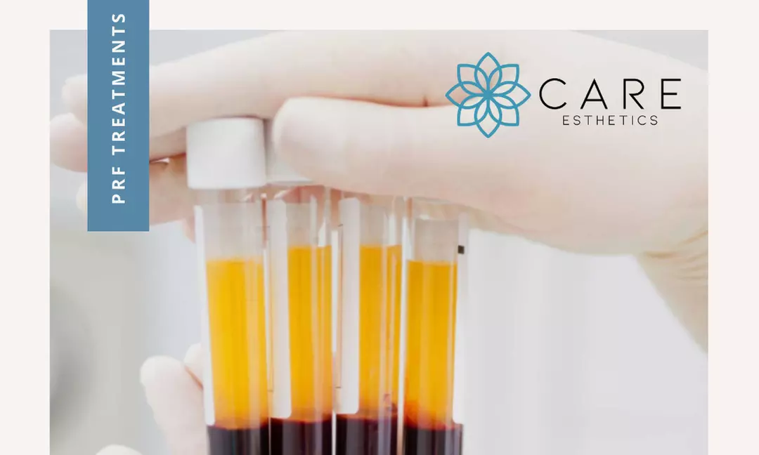 Up to 55% Off on Micro-needling at TruYou West Caldwell
