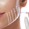 Image 1: Up to 64% Off on Facelift - Thread Lift at DermAlign Medical Aesthetics